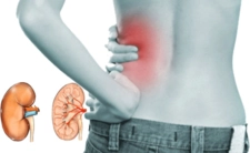 Böbrek İltihabı Belirtileri ve Tedavisi Böbrek İltihabı Belirtileri ve Tedavisi